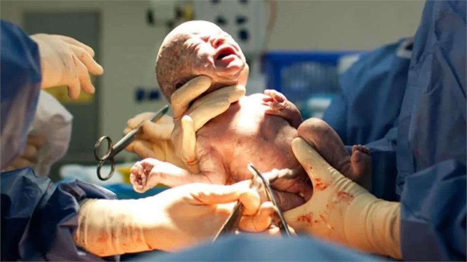 Unnecessary Cesarean Deliveries Threaten Mother and Baby’s Health